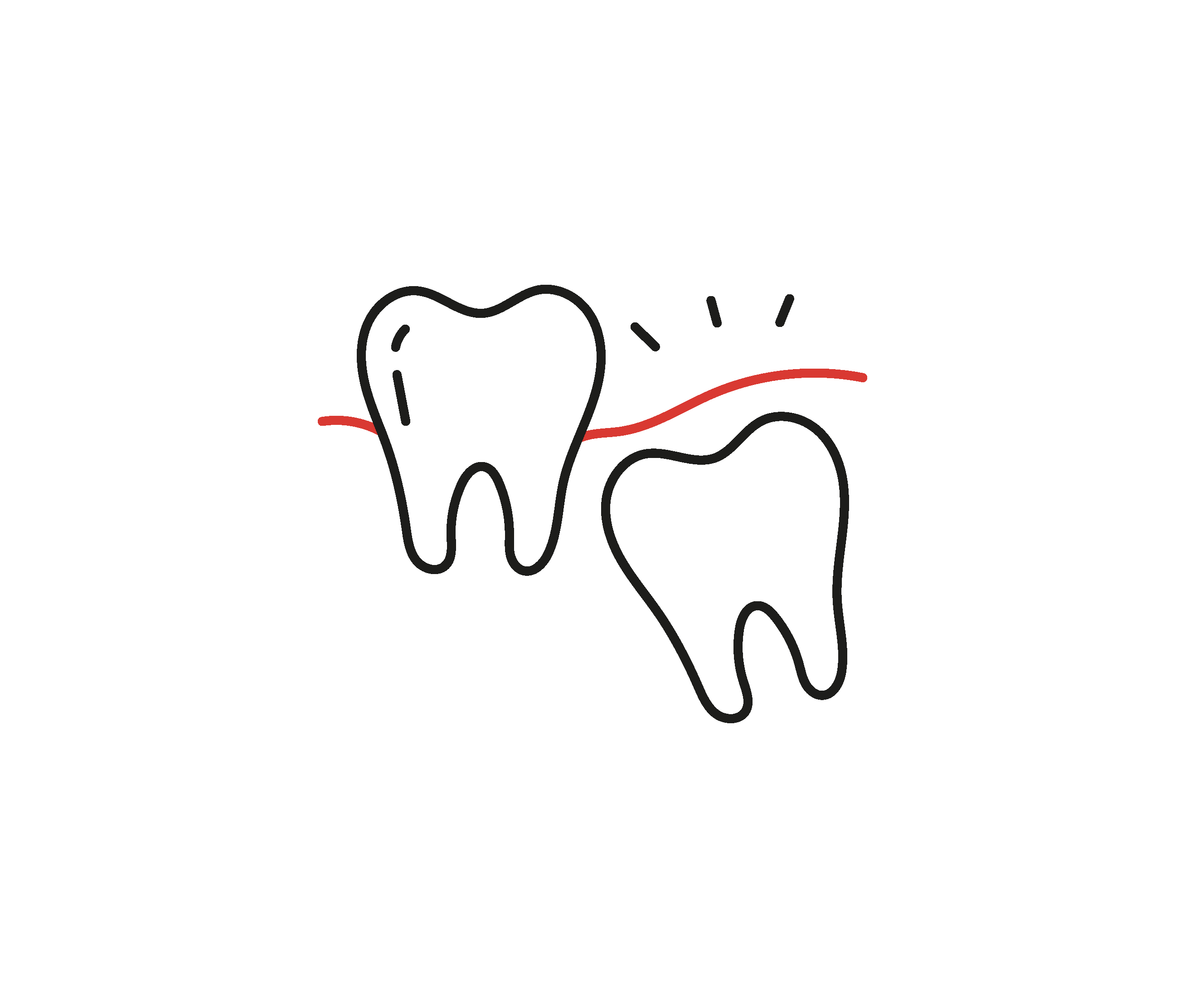 Extractions des dents de sagesse à Princeville