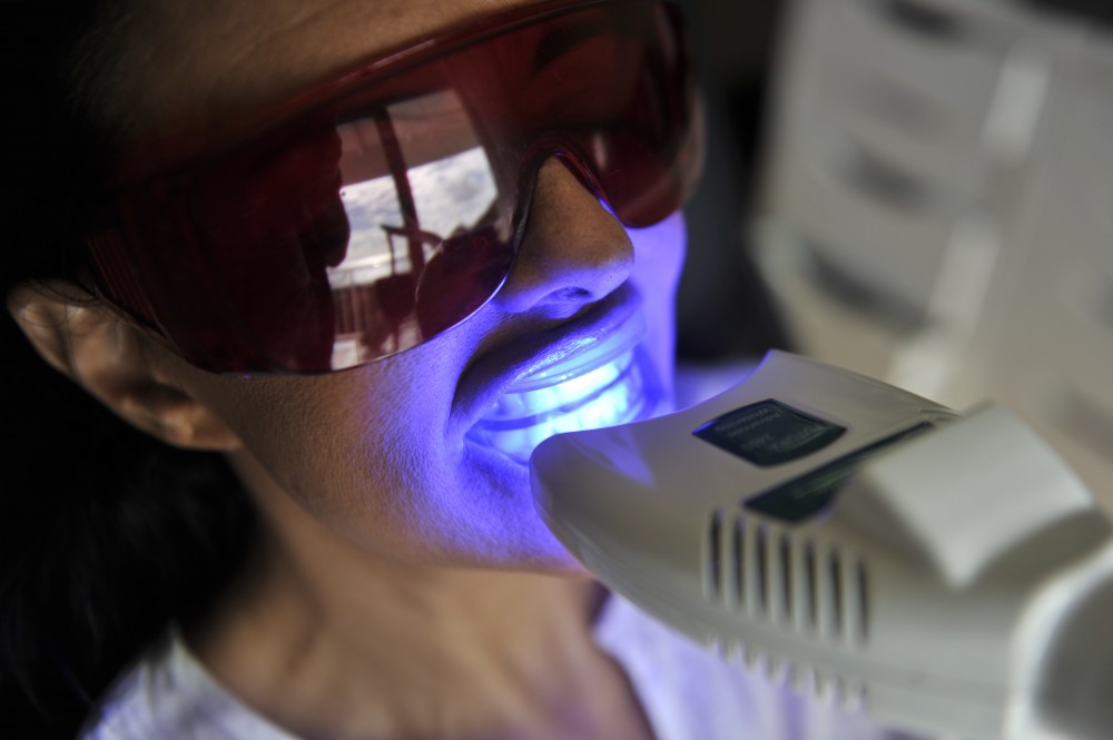 Le blanchiment des dents à la chaise aux cliniques dentaires de Princeville